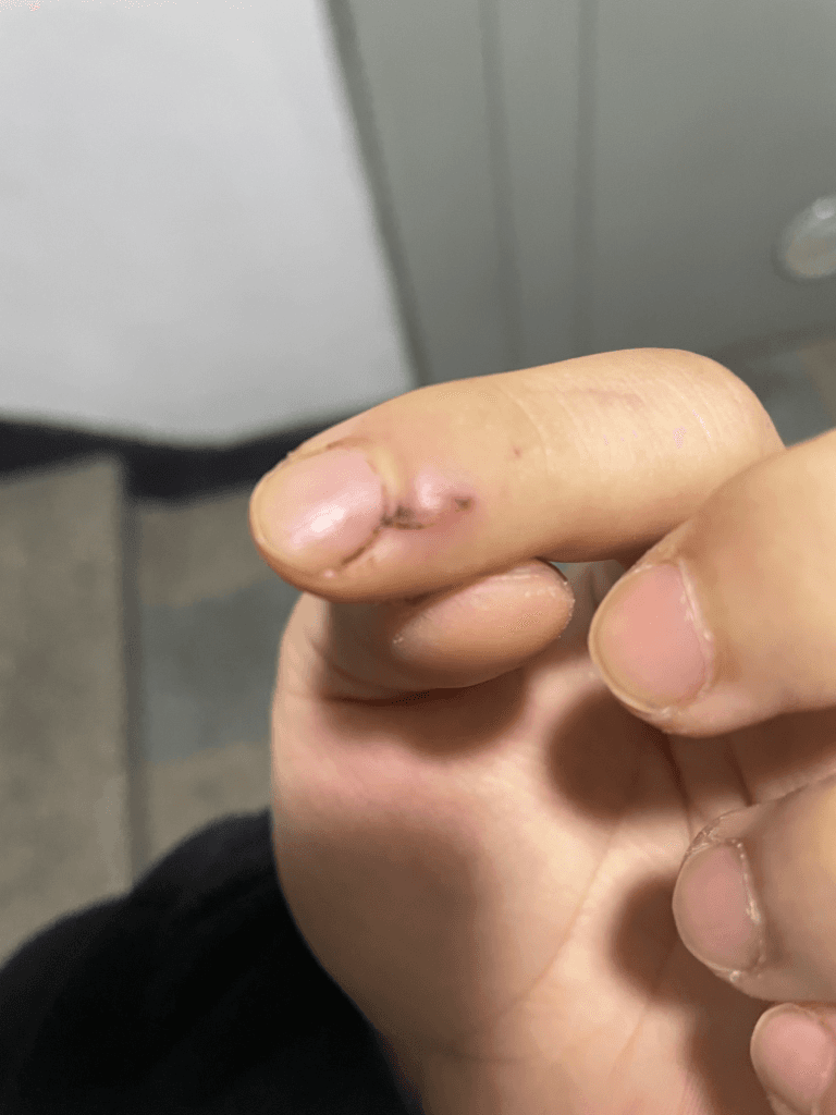 2번 째 사진