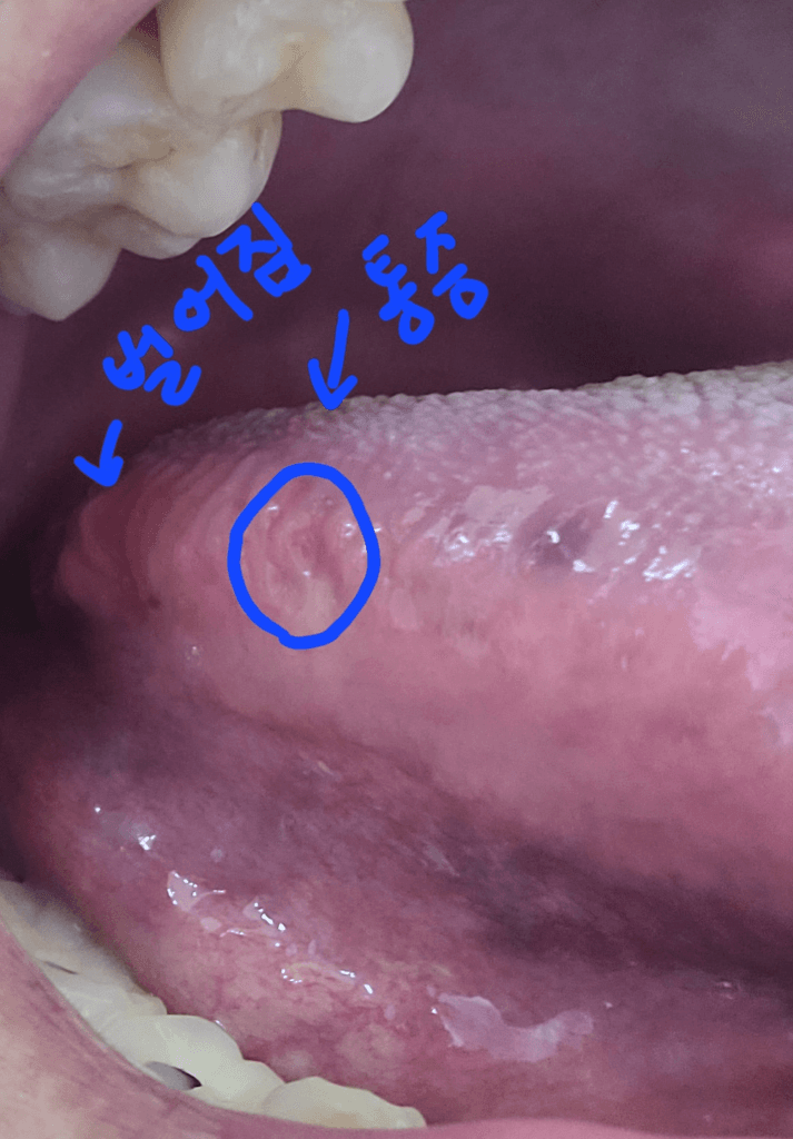 3번 째 사진