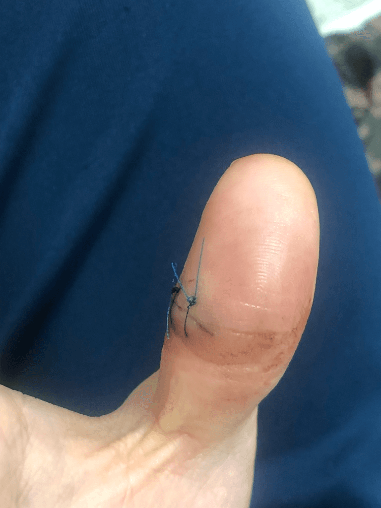 2번 째 사진