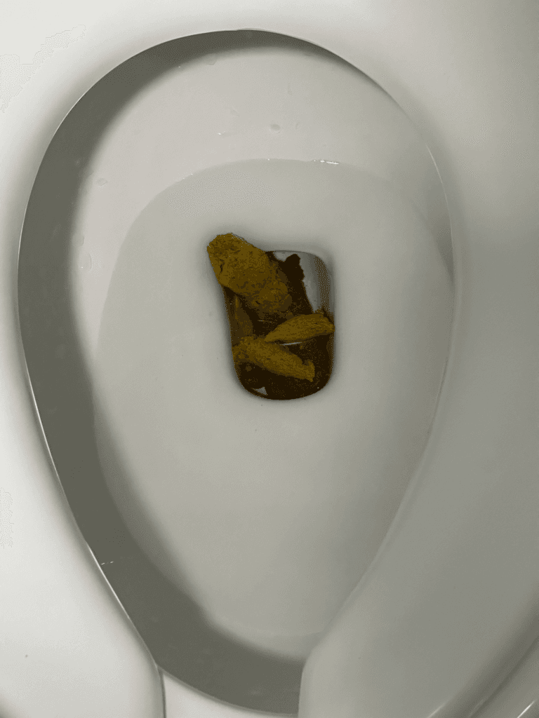 3번 째 사진