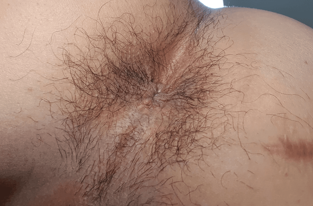 1번 째 사진