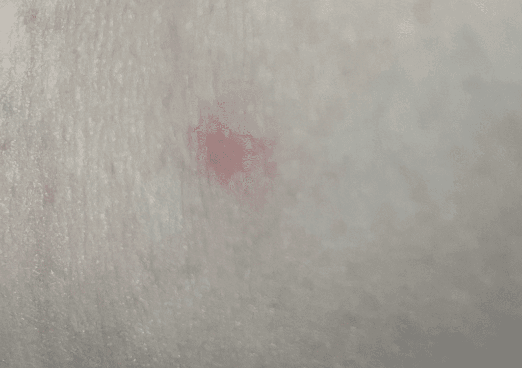 1번 째 사진