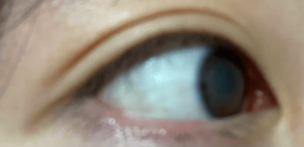 2번 째 사진