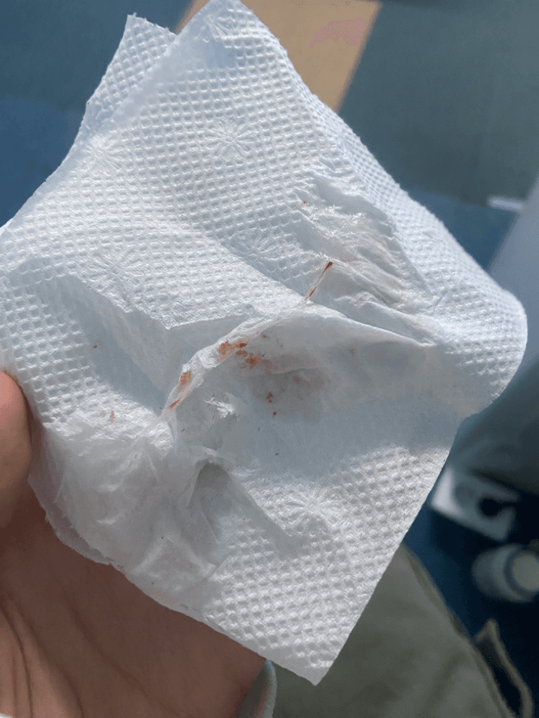 1번 째 사진