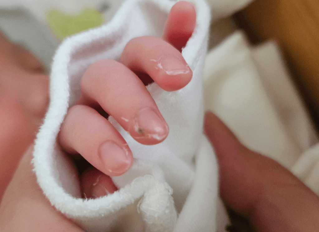 1번 째 사진