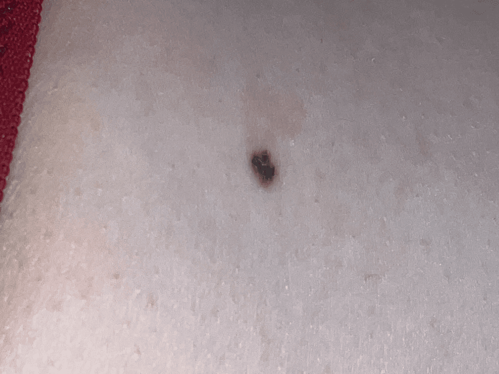 2번 째 사진