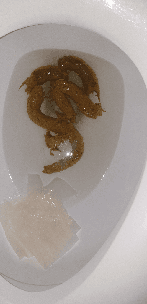 2번 째 사진