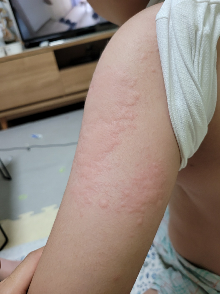 2번 째 사진