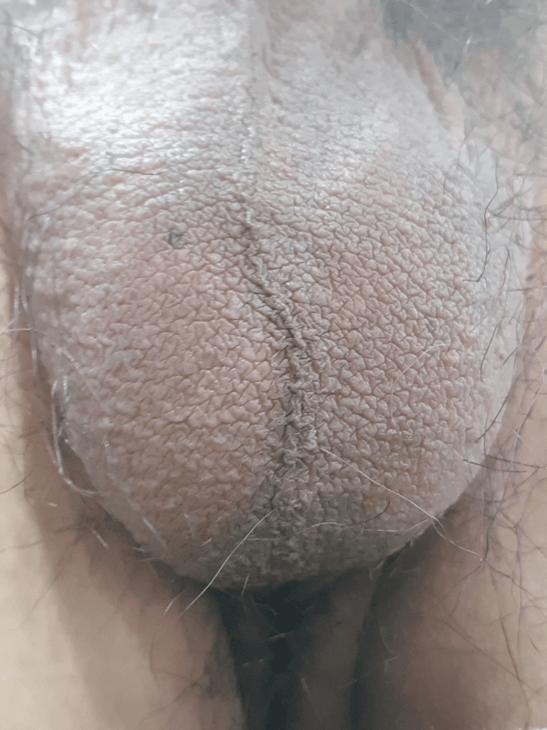 3번 째 사진