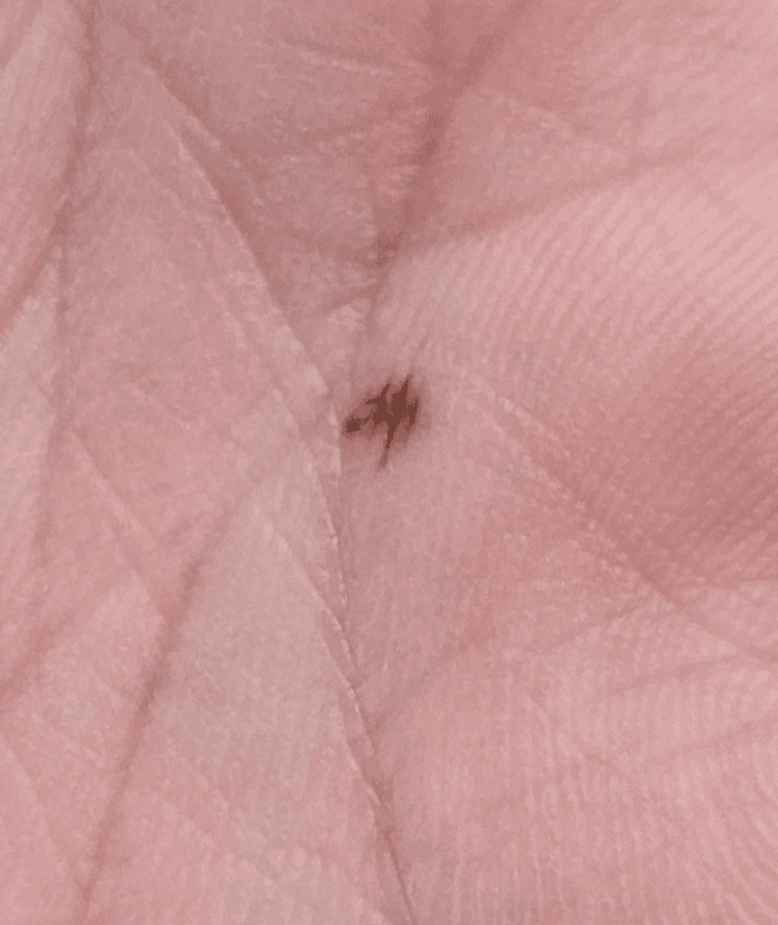 3번 째 사진