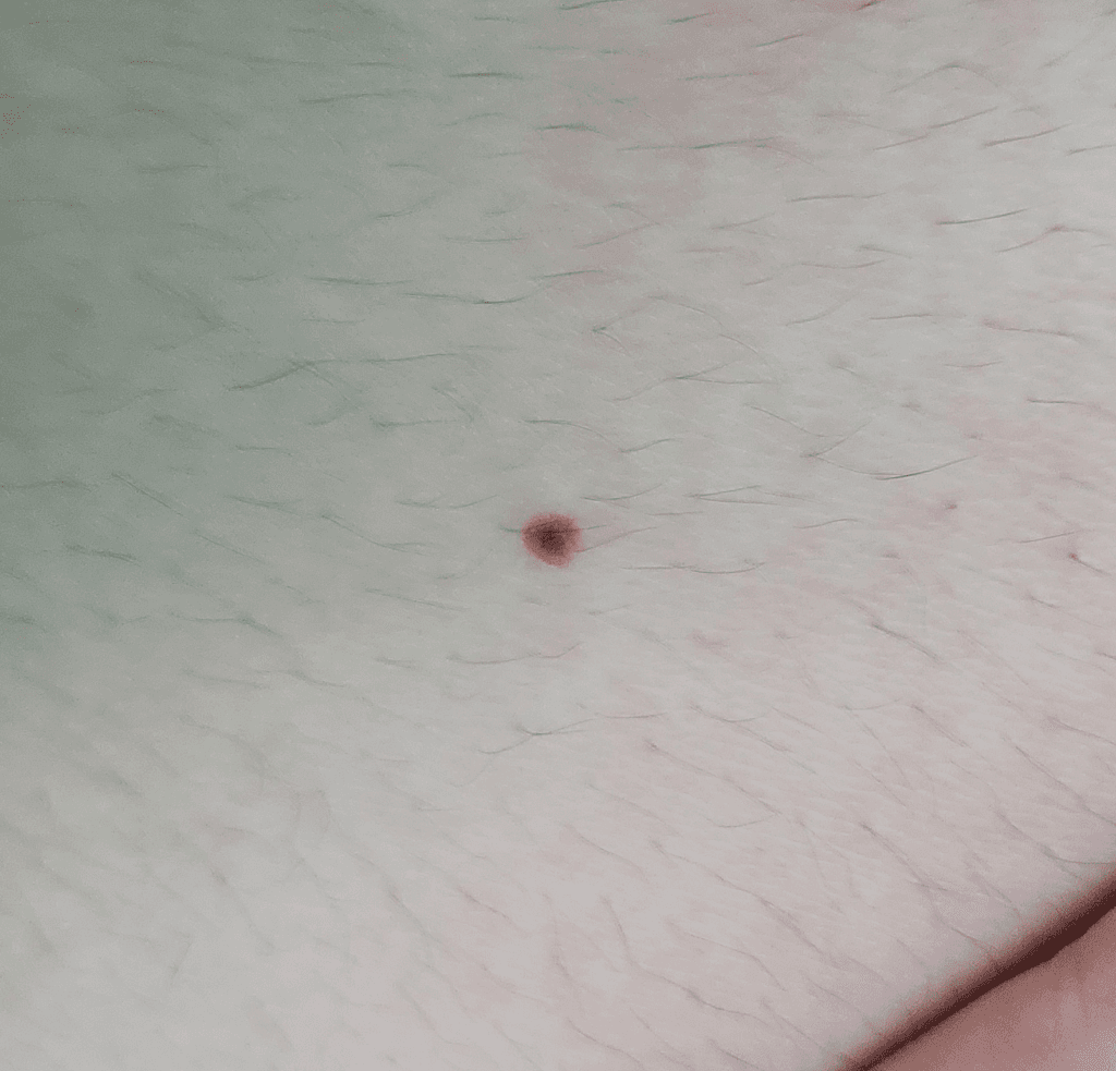 2번 째 사진
