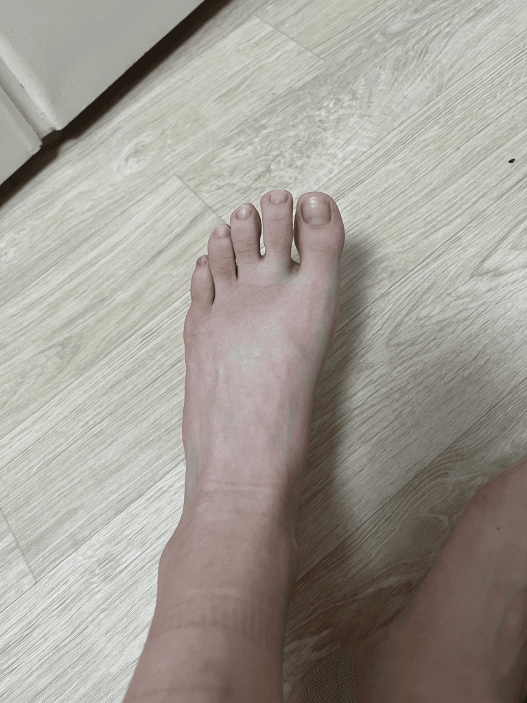 2번 째 사진