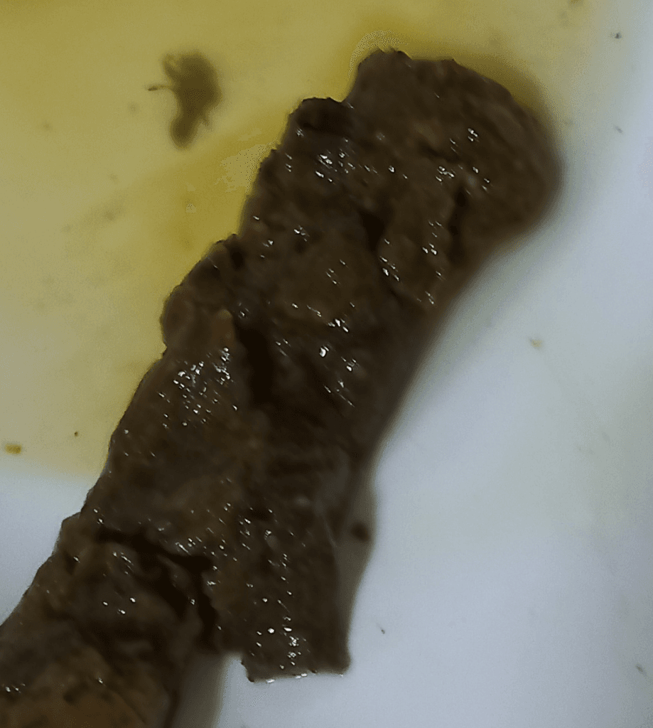 2번 째 사진
