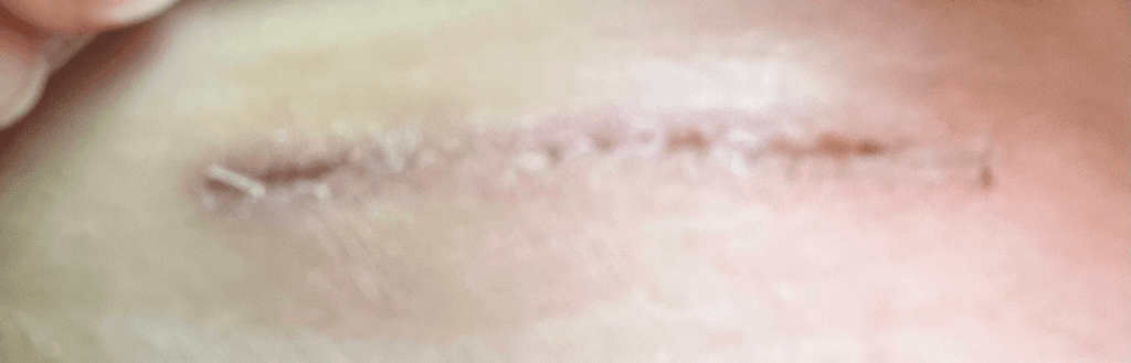 2번 째 사진
