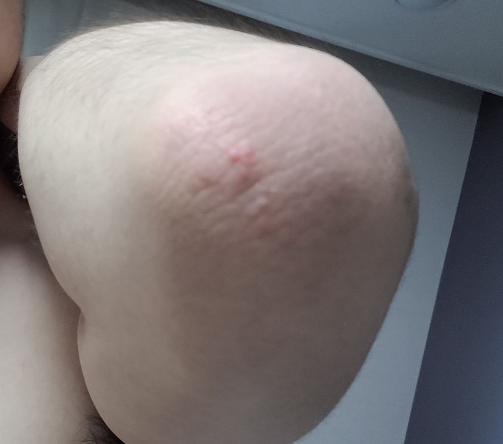 2번 째 사진