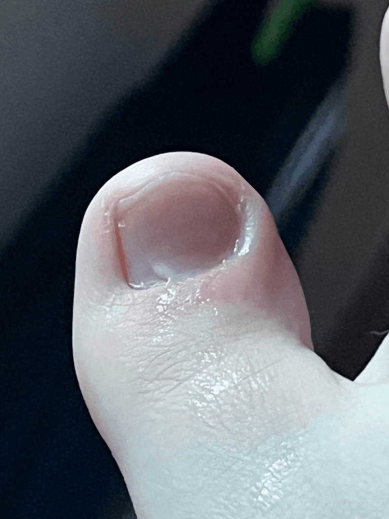 2번 째 사진