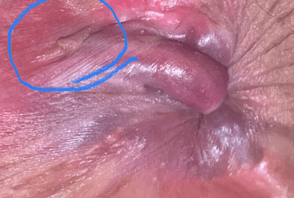 7번 째 사진