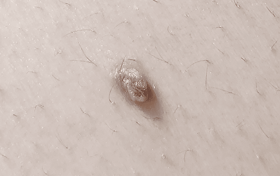2번 째 사진