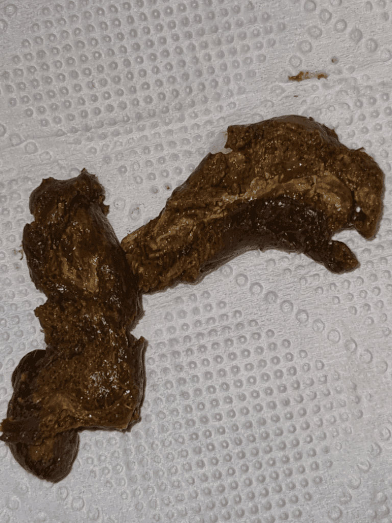 4번 째 사진