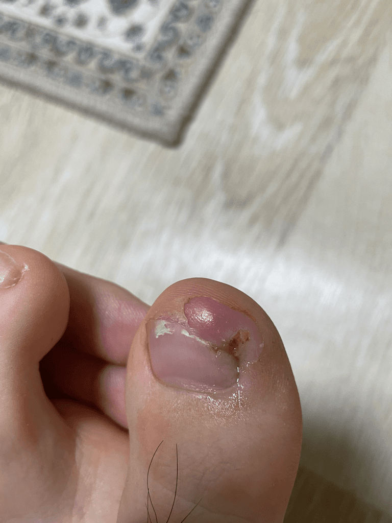 5번 째 사진