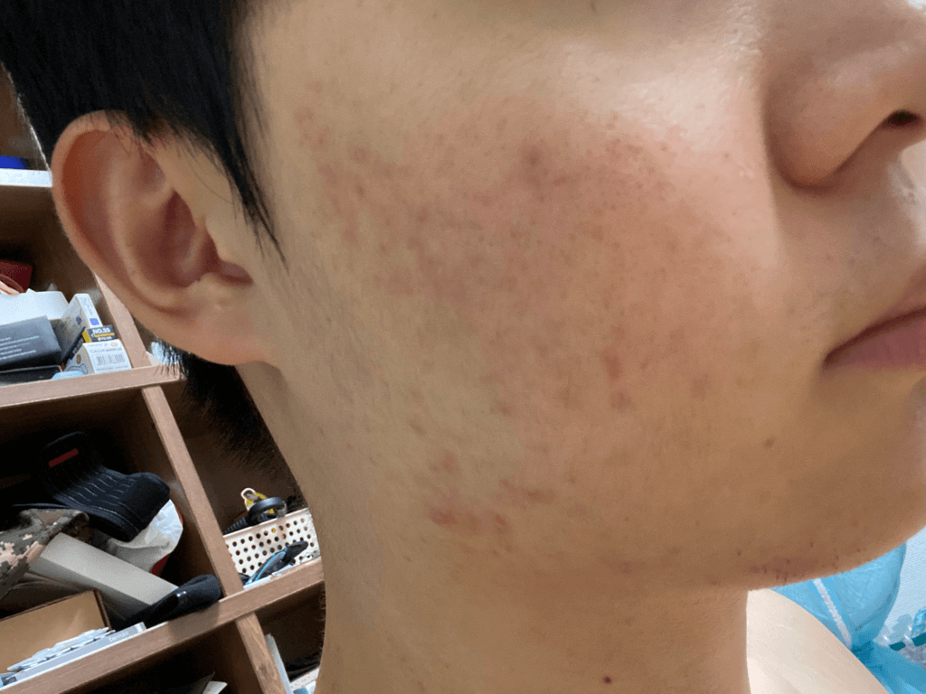 1번 째 사진