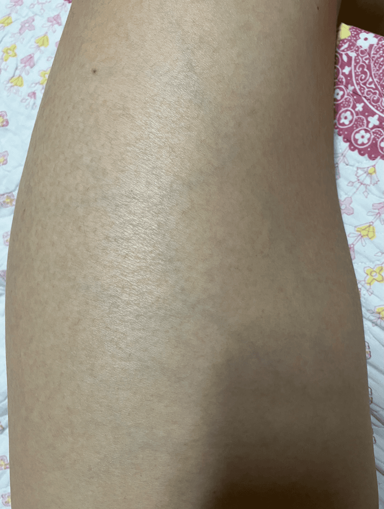 2번 째 사진