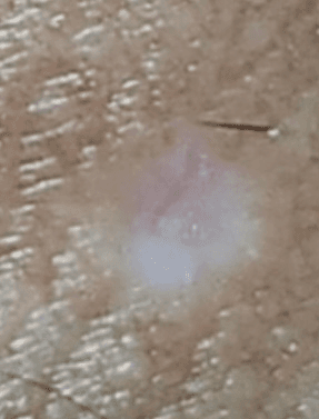3번 째 사진