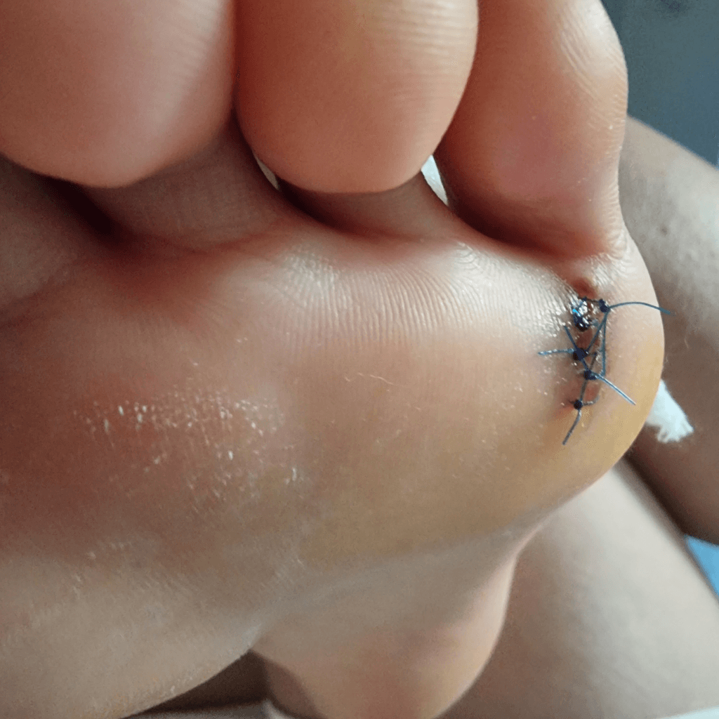 2번 째 사진