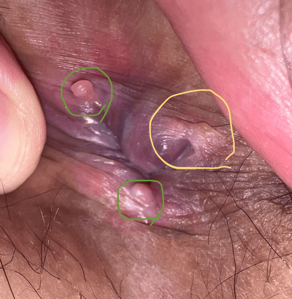 3번 째 사진