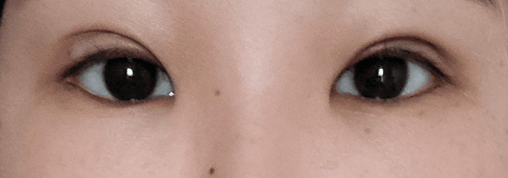2번 째 사진