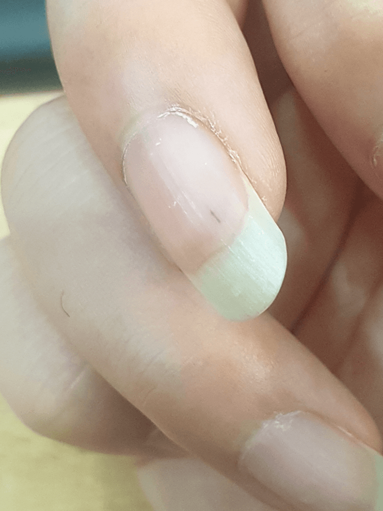 2번 째 사진