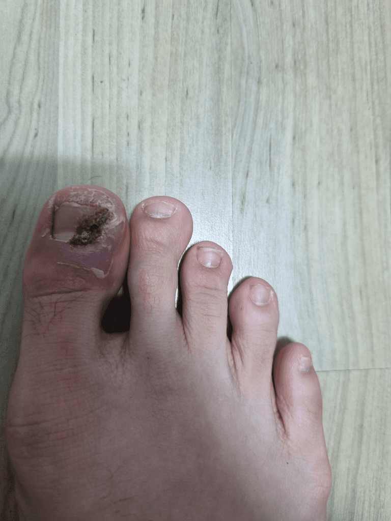 2번 째 사진