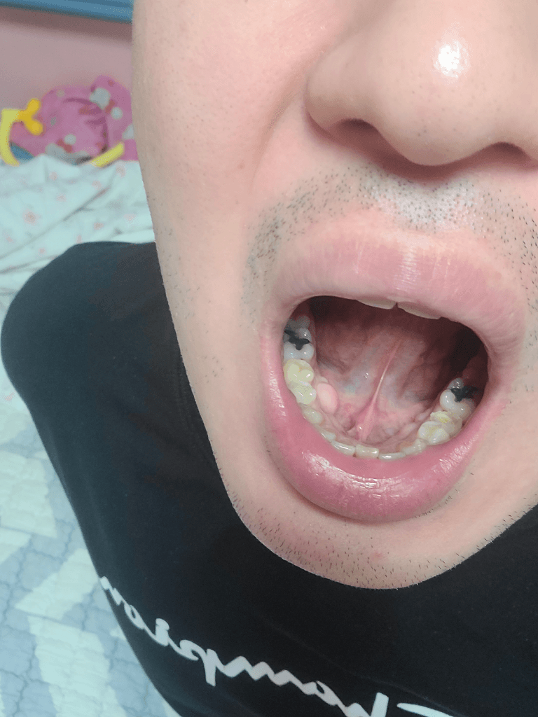 1번 째 사진