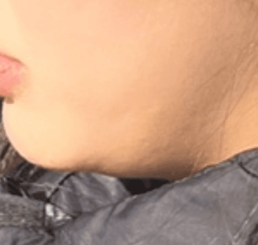 5번 째 사진