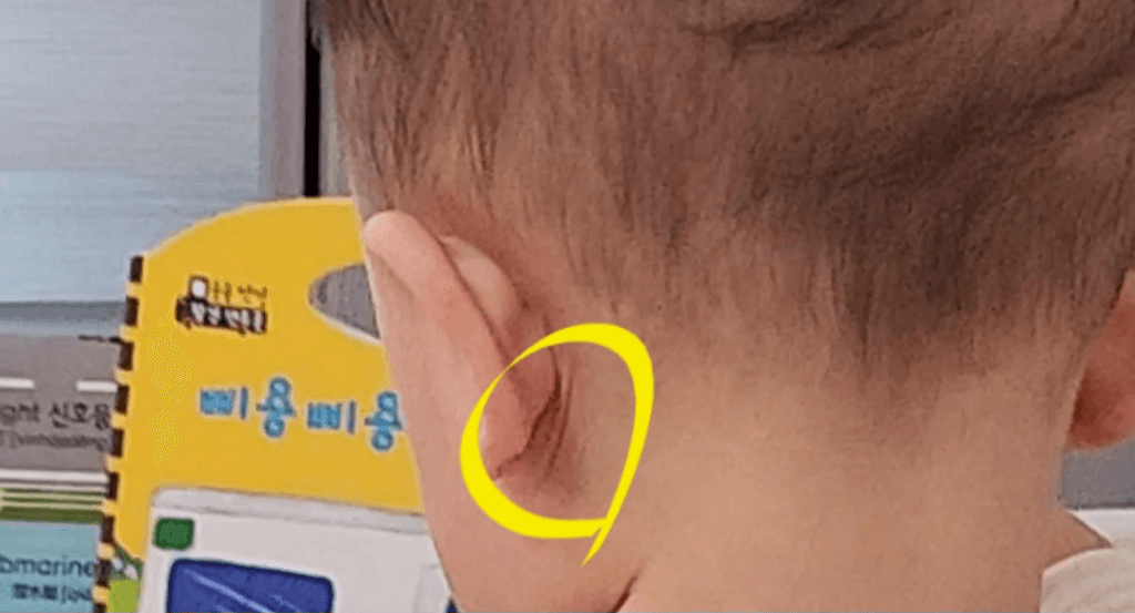 1번 째 사진