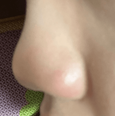 2번 째 사진
