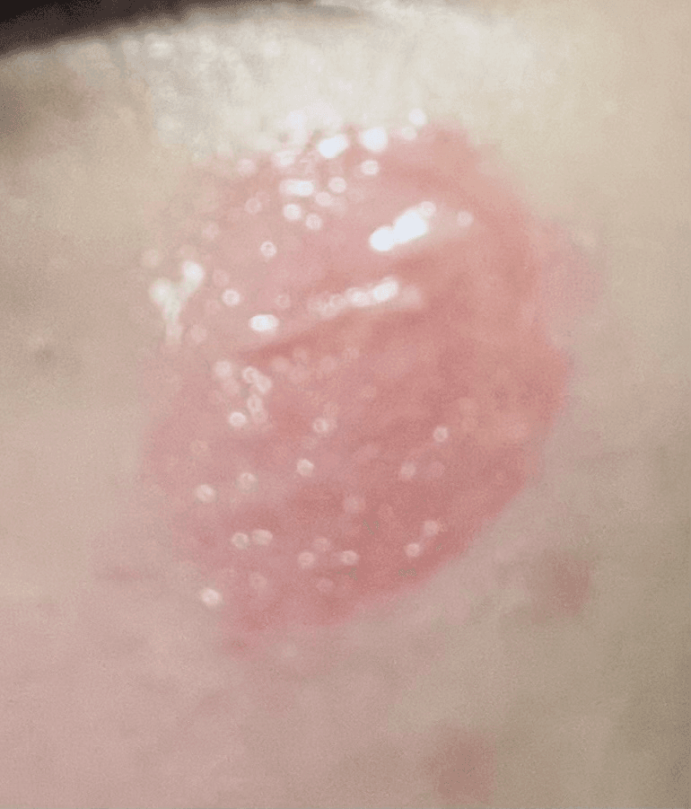 2번 째 사진