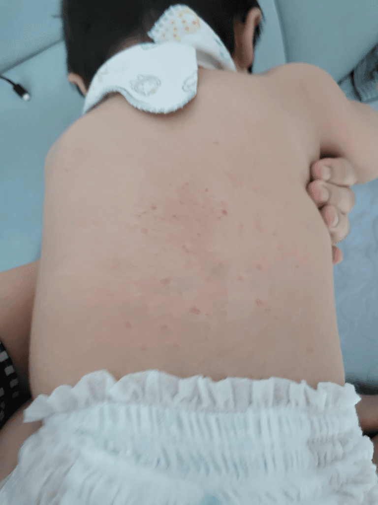 2번 째 사진