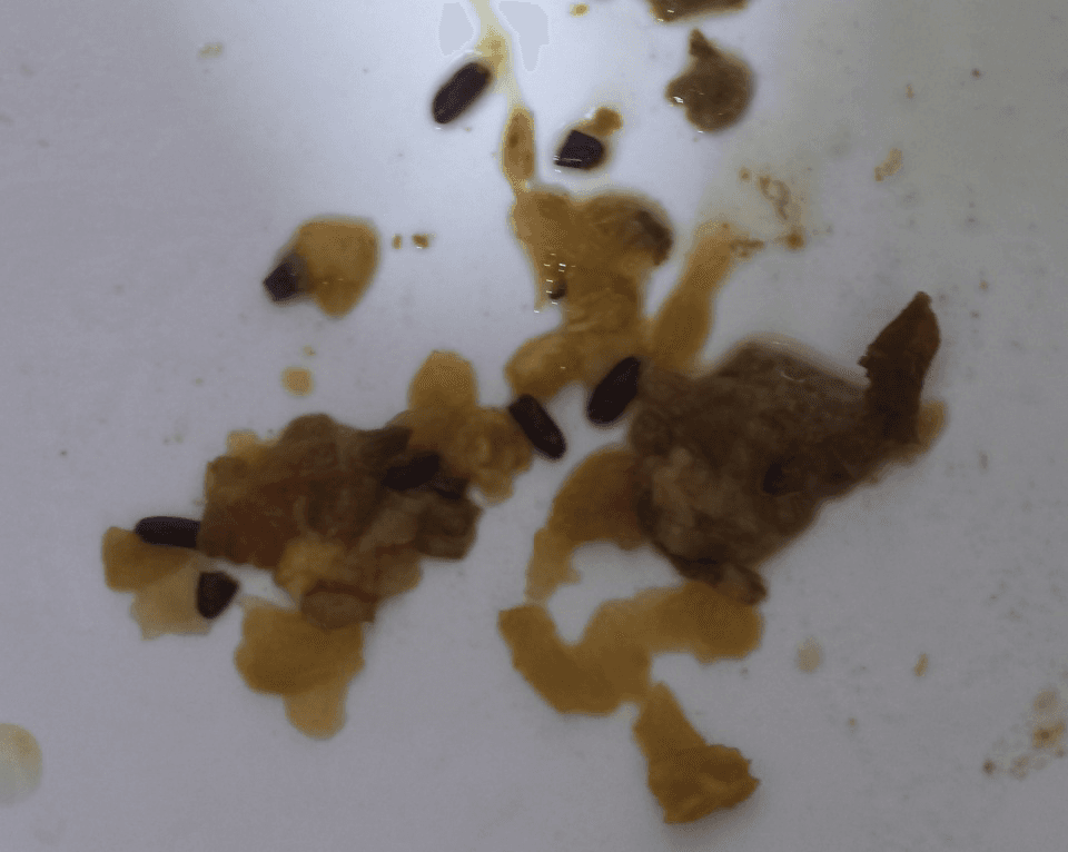 2번 째 사진