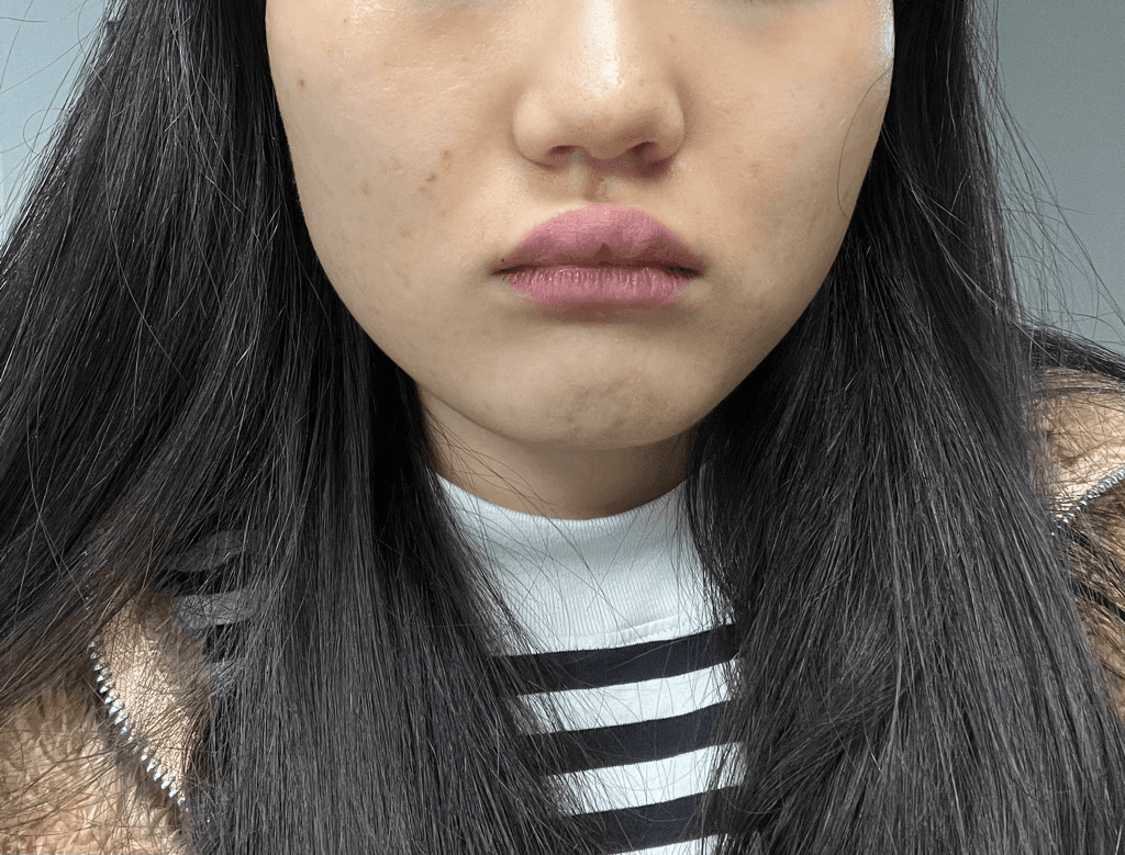 2번 째 사진