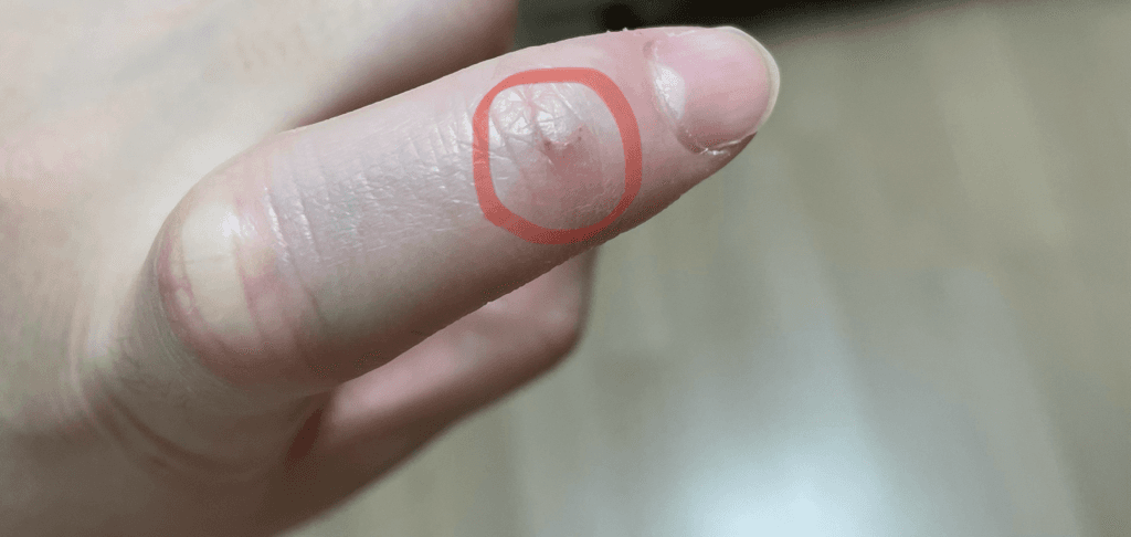2번 째 사진