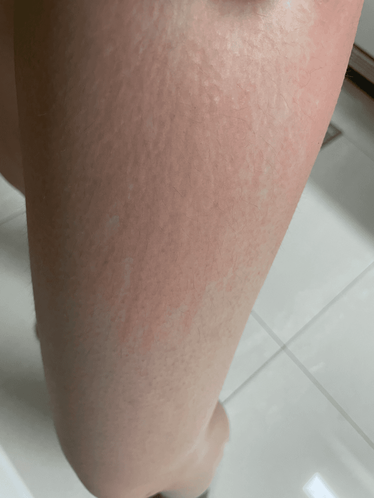 2번 째 사진