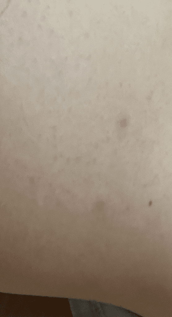 2번 째 사진