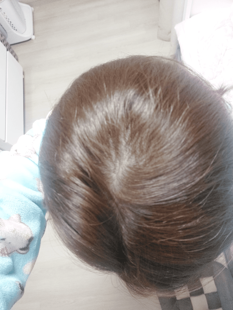2번 째 사진