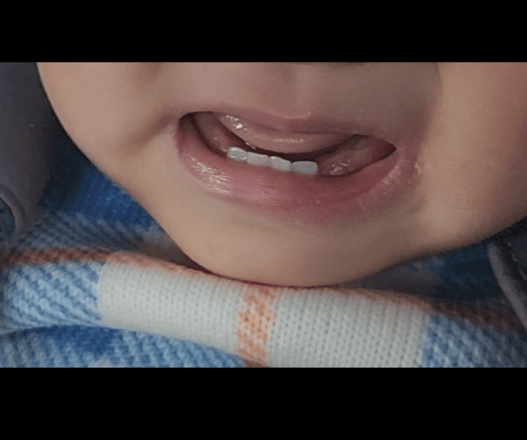 2번 째 사진