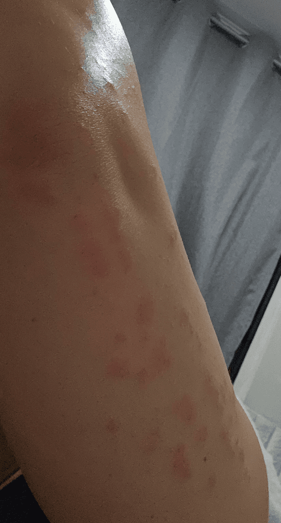 2번 째 사진