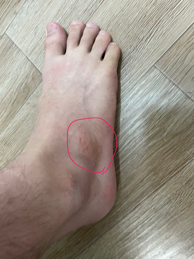 3번 째 사진