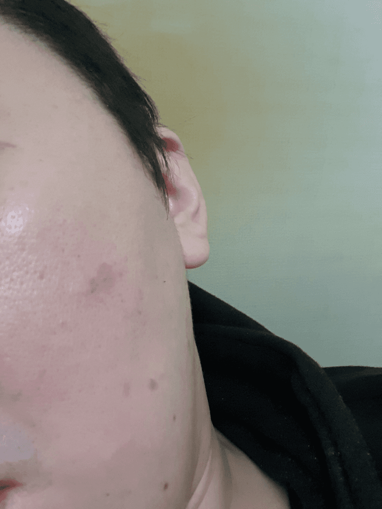 2번 째 사진