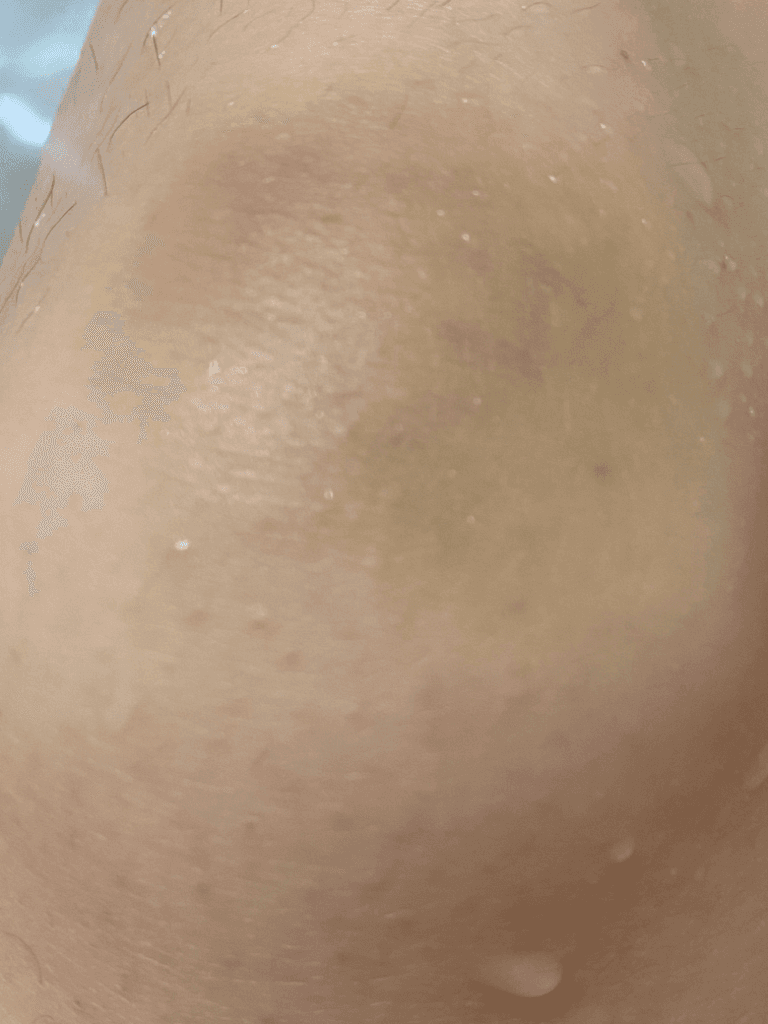 4번 째 사진