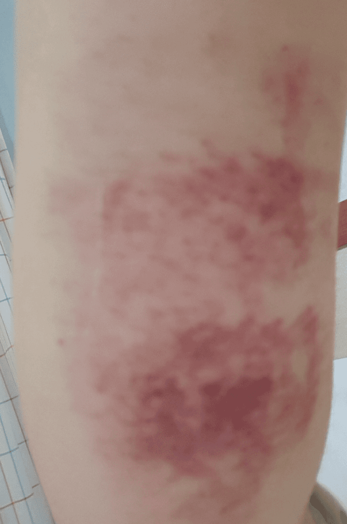1번 째 사진